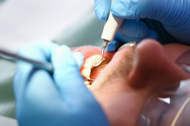 Best Emergency Dental Care for Broken or Chipped Teeth in Nuevo, CA