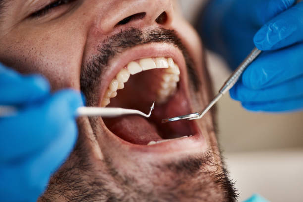 Best Same-Day Emergency Dental Services in Nuevo, CA