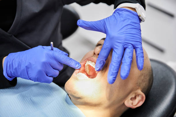 Best Urgent Care for Lost Fillings or Crowns in Nuevo, CA